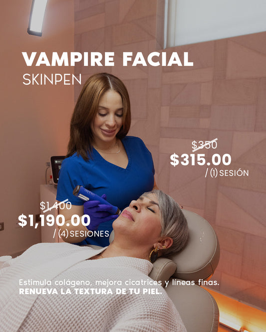 Vampire Facial